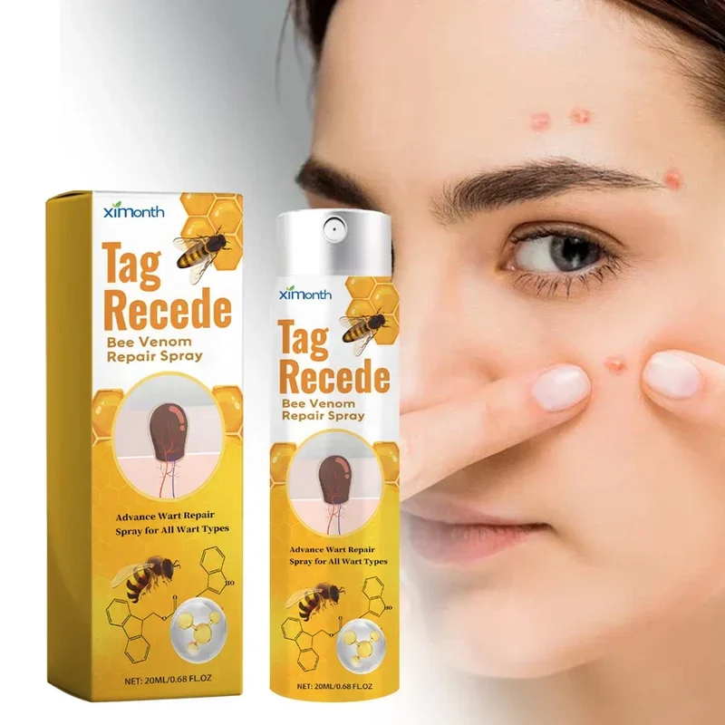 TagAway - Effektiv Warzen und Hautwucherungen entfernen